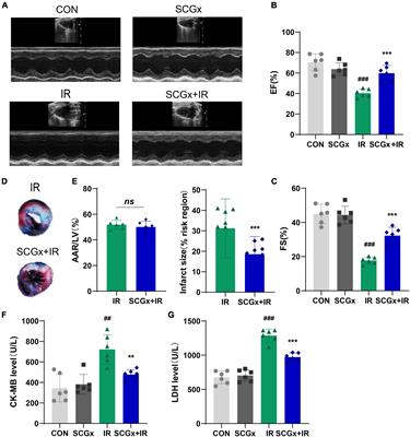 Bilateral Superior Cervical Sympathectomy Activates Signal Transducer and Activator of Transcription 3 Signal to Alleviate Myocardial Ischemia-Reperfusion Injury